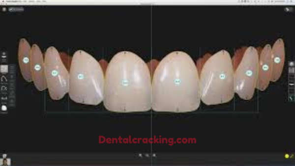 smile designer pro dental sotware