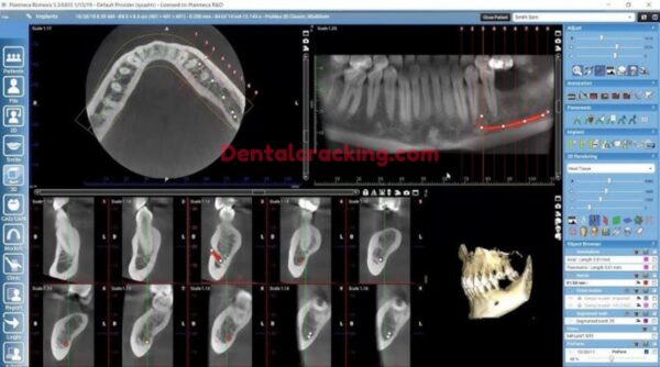 Romexis Planmeca 6.4.6 crack