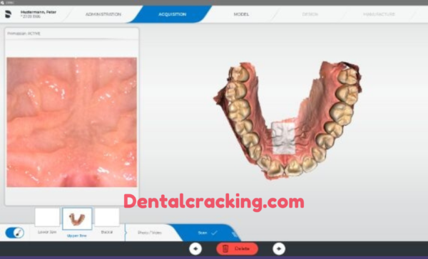 cerec software download