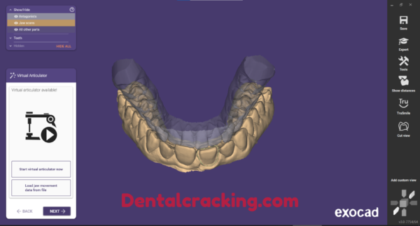 exocad dental​ software​ download