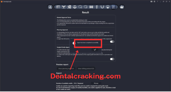 DentiqGuide 1.3.04 Crack 2025 - Image 3