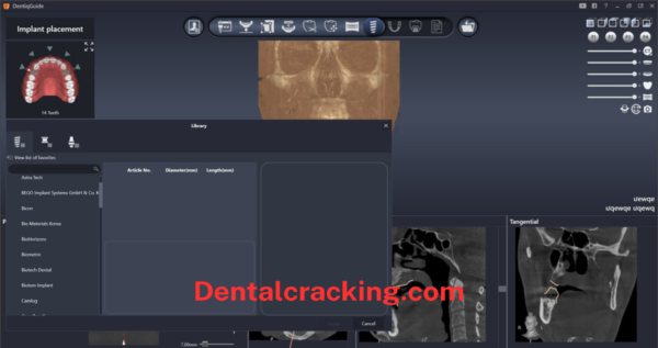 DentiqGuide 1.3.04 Crack 2025