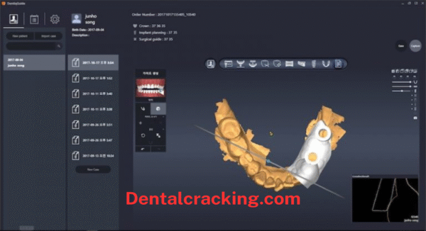 DentiqGuide 1.3.05 Crack 2025