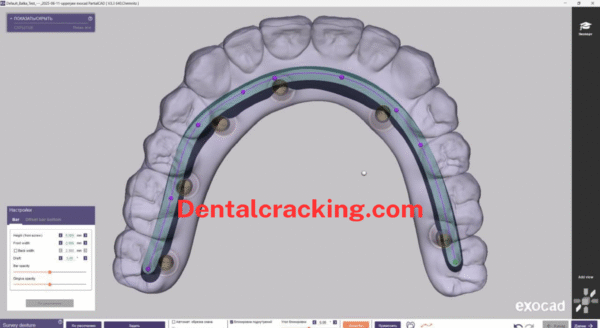 Exocad PartialCAD 3.3 Crack Chemnitz (2025) - Image 3