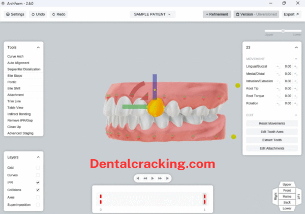 ArchForm 2.6 Last 2025 Crack Direct Print Aligners